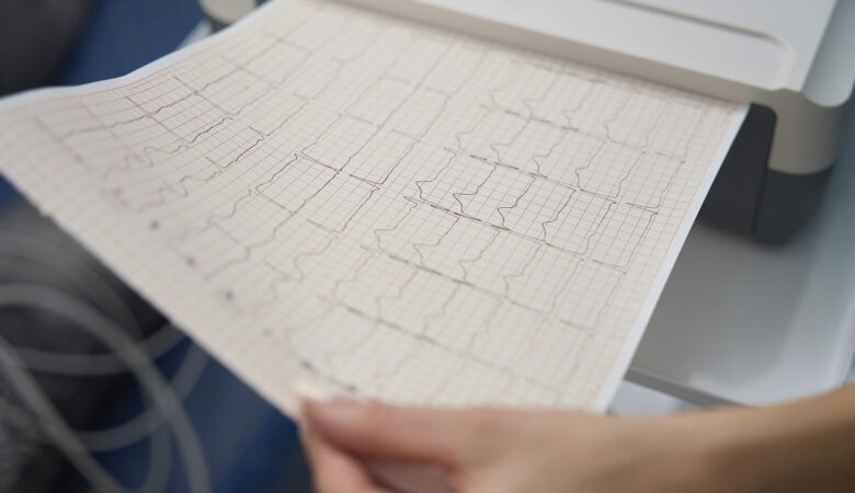O que seu eletrocardiograma pode mostrar sem você sentir nada?